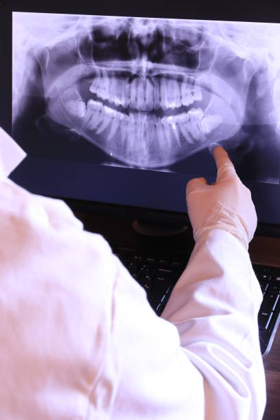 Best Broken or Cracked Tooth Emergency Dentist in Great Falls, VA